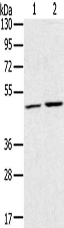 Gel: 8%SDS-PAGE, Lysate: 40 ug, Lane 1-2: K562 cells, NIH/3T3 cells, Primary antibody: CSB-PA038367(RRAGC Antibody) at dilution 1/400, Secondary antibody: Goat anti rabbit IgG at 1/8000 dilution, Exposure time: 5 seconds