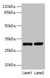Western blot All lanes: UQCRQ antibody at 2µg/ml Lane 1: EC109 whole cell lysate Lane 2: 293T whole cell lysate Secondary Goat polyclonal to rabbit IgG at 1/15000 dilution Predicted band size: 10 kDa Observed band size: 30 kDa