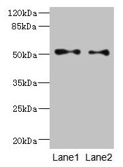 Western blot All lanes: TUBB3 antibody at 6µg/ml Lane 1: A549 whole cell lysate Lane 2: A431 whole cell lysate Secondary Goat polyclonal to rabbit IgG at 1/10000 dilution Predicted band size: 51, 43 kDa Observed band size: 51 kDa
