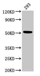 Western Blot Positive WB detected in: 293 whole cell lysate All lanes: TUBB3 antibody at 3µg/ml Secondary Goat polyclonal to rabbit IgG at 1/50000 dilution Predicted band size: 51, 43 kDa Observed band size: 51 kDa