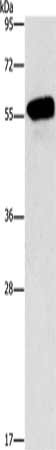 Gel: 6%SDS-PAGE, Lysate: 40 ug, Lane: Mouse eyes tissue, Primary antibody: CSB-PA039712(CDK19 Antibody) at dilution 1/950, Secondary antibody: Goat anti rabbit IgG at 1/8000 dilution, Exposure time: 1 minute