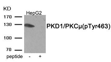 Western blot analysis of extracts from HepG2 tissue using PKD1/PKC μ (Phospho-Tyr463) antibody.The lane on the right is treated with the antigen-specific peptide.