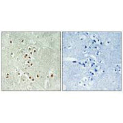 Immunohistochemistry analysis of paraffin-embedded human brain tissue using GADD45GIP1 antibody.