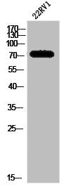 Western Blot analysis of 22RV1 cells using SphK2 Polyclonal Antibody