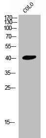 Western Blot analysis of COLO cells using CysLTR2 Polyclonal Antibody