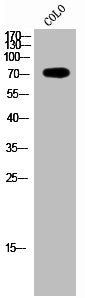 Western Blot analysis of COLO cells using PAK5/6 Polyclonal Antibody