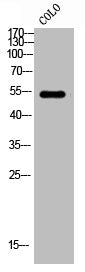 Western Blot analysis of COLO cells using PTH/PTHrP-R Polyclonal Antibody