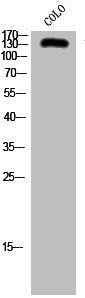 Western Blot analysis of COLO cells using SFRS15 Polyclonal Antibody