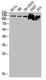Western blot analysis of HELA KB SH-SY5Y 293T 3T3 lysis using FAK antibody.