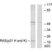 Western blot analysis of extracts from HeLa cells, using RASH/RASK/RASN antibody.