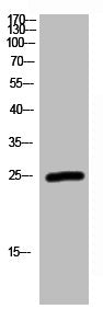 Western Blot analysis of A549 cells using Rab 2A Polyclonal Antibody
