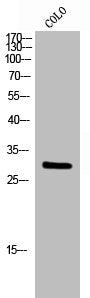 Western Blot analysis of COLO cells using Rab 6A Polyclonal Antibody