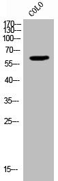 Western Blot analysis of CoLo cells using RBQ-3 Polyclonal Antibody