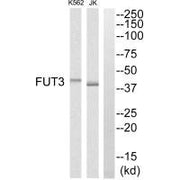 Western blot analysis of extracts from K562 cells and Jurkat cells, using MRPS7 antibody.