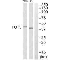 Western blot analysis of extracts from K562 cells and Jurkat cells, using MRPS7 antibody.