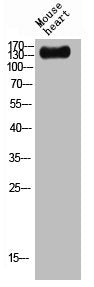 Western blot analysis of mouse-heart lysis using Plakophilin 4 antibody.