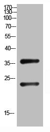 Western Blot analysis of customer's (cat sample) using QM Polyclonal Antibody.