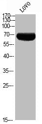 Western blot analysis of LOVO using p-p70 S6 kinase α (T444) antibody.