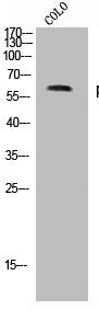 Western Blot analysis of COLO cells using Phospho-p70 S6 kinase α (S371) Polyclonal Antibody