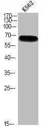 Western blot analysis of K562 using p-p70 S6 kinase α (S427) antibody.