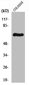 Western Blot analysis of Colo205 cells using p70 S6 kinase α Polyclonal Antibody