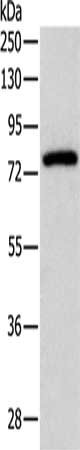 Gel: 10%SDS-PAGE, Lysate: 40 ug, Lane: Mouse brain tissue, Primary antibody: CSB-PA040495(PRKCG Antibody) at dilution 1/500, Secondary antibody: Goat anti rabbit IgG at 1/8000 dilution, Exposure time: 20 seconds