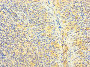 Immunohistochemistry of paraffin-embedded human tonsil tissue using CSB-PA04059A0Rb at dilution of 1:100