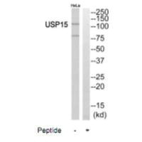 Western blot analysis of extracts from HeLa cells, using USP15 antibody.
