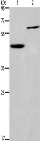 Gel: 8%SDS-PAGE,Lysate: 40 ug,Lane 1-2: Human hepatocellsular carcinoma tissue, Jurkat cells,Primary antibody: CSB-PA040823(DOK1 Antibody) at dilution 1/450 dilution,Secondary antibody: Goat anti rabbit IgG at 1/8000 dilution,Exposure time: 20 sec...