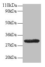 Western blot All lanes: GPR161 antibody at 2µg/ml + EC109 whole cell lysate Secondary Goat polyclonal to rabbit IgG at 1/15000 dilution Predicted band size: 59, 46, 44, 50, 47, 61 kDa Observed band size: 30 kDa