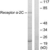 Western blot analysis of extracts from HepG2 cells, using Adrenergic Receptor α-2C antibody.