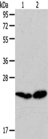 Gel: 10%SDS-PAGE,Lysate: 40 ug,Lane 1-2: A549 cells, Lovo cells,Primary antibody: CSB-PA041280(RAB5C Antibody) at dilution 1/100 dilution,Secondary antibody: Goat anti rabbit IgG at 1/8000 dilution,Exposure time: 30 seconds