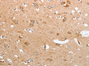 The image on the left is immunohistochemistry of paraffin-embedded Human brain tissue using CSB-PA041334(CASP12 Antibody) at dilution 1/50, on the right is treated with synthetic peptide. (Original magnification: ×200)