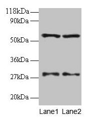 Western blot All lanes: SARS antibody at 2µg/ml Lane 1: EC109 whole cell lysate Lane 2: 293T whole cell lysate Secondary Goat polyclonal to rabbit IgG at 1/15000 dilution Predicted band size: 59 kDa Observed band size: 59 kDa
