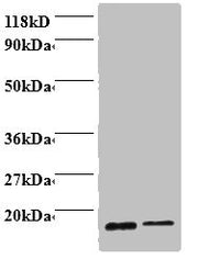 Western blot All lanes: Profilin-1 antibody at 2ug/ml Lane 1: EC109 whole cell lysate Lane 2: 293T whole cell lysate Secondary Goat polyclonal to rabbit IgG at 1/15000 dilution Predicted band size: 16 kDa Observed band size: 16 kDa