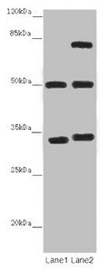 Western blot All lanes: TUBA1B antibody at 12 µg/ml Lane 1: Mouse brain tissue Lane 2: Mouse liver tissue Secondary Goat polyclonal to rabbit IgG at 1/10000 dilution Predicted band size: 51, 38 kDa Observed band size: 51, 34, 75 kDa