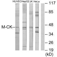 Western blot analysis of extracts from HUVEC cells, HepG2 cells, Jurkat cells and HeLa cells, using M-CK antibody.