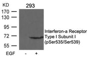 Western blot analysis of extracts from 293 cells untreated or treated with EGF using Interferon-a Receptor Type I Subunit I (phospho-Ser535/Ser539) Antibody.