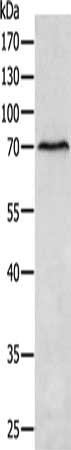 Gel: 10%SDS-PAGE, Lysate: 40 ug, Lane: Human liver cancer tissue, Primary antibody: CSB-PA042030(MATN4 Antibody) at dilution 1/400, Secondary antibody: Goat anti rabbit IgG at 1/8000 dilution, Exposure time: 30 seconds