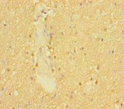 Immunohistochemistry of paraffin-embedded human brain tissue using CSB-PA04209A0Rb at dilution of 1:100