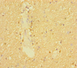 Immunohistochemistry of paraffin-embedded human brain tissue using CSB-PA04209A0Rb at dilution of 1:100