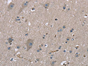 The image on the left is immunohistochemistry of paraffin-embedded Human brain tissue using CSB-PA042133(MYL12B Antibody) at dilution 1/20, on the right is treated with fusion protein. (Original magnification: ×200)