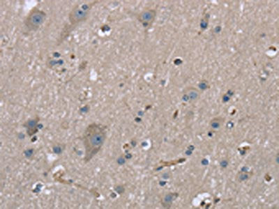 The image on the left is immunohistochemistry of paraffin-embedded Human brain tissue using CSB-PA042133(MYL12B Antibody) at dilution 1/20, on the right is treated with fusion protein. (Original magnification: ×200)