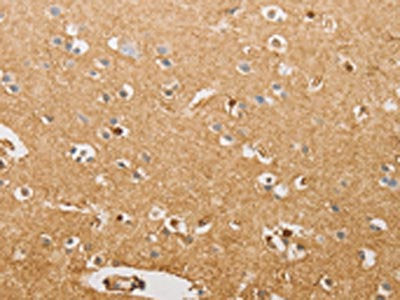 The image on the left is immunohistochemistry of paraffin-embedded Human brain tissue using CSB-PA042178(S100A1 Antibody) at dilution 1/20, on the right is treated with fusion protein. (Original magnification: ×200)