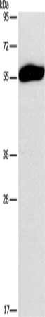 Gel: 8%SDS-PAGE, Lysate: 40 ug, Lane: Human testis tissue, Primary antibody: CSB-PA042228(SPAG6 Antibody) at dilution 1/200, Secondary antibody: Goat anti rabbit IgG at 1/8000 dilution, Exposure time: 10 minutes