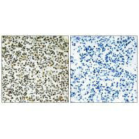 Immunohistochemistry analysis of paraffin-embedded human lymph node tissue using CEP152 antibody.