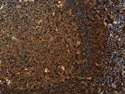 The image on the left is immunohistochemistry of paraffin-embedded Human tonsil tissue using CSB-PA042402(CLDN8 Antibody) at dilution 1/50, on the right is treated with synthetic peptide. (Original magnification: ×200)