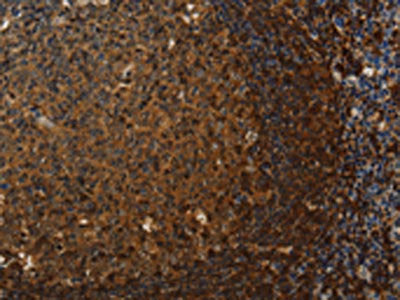 The image on the left is immunohistochemistry of paraffin-embedded Human tonsil tissue using CSB-PA042402(CLDN8 Antibody) at dilution 1/50, on the right is treated with synthetic peptide. (Original magnification: ×200)