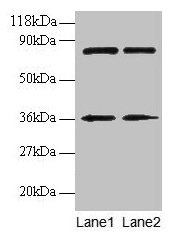 Western blot All lanes: HNRNPH1 antibody at 2µg/ml Lane 1: EC109 whole cell lysate Lane 2: 293T whole cell lysate Secondary Goat polyclonal to rabbit IgG at 1/15000 dilution Predicted band size: 50 kDa Observed band size: 36 kDa