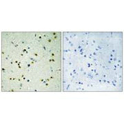 Immunohistochemistry analysis of paraffin-embedded human brain tissue, using JHD3B antibody.